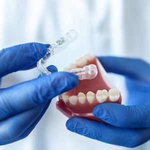 Close-up of the doctor’s hands in blue gloves hold an artificial model of the jaw with invisible braces. The dentist shows an example of tooth alignment.