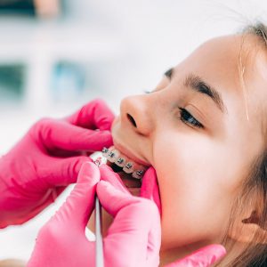 Orthodontist fixing girl’s dental braces